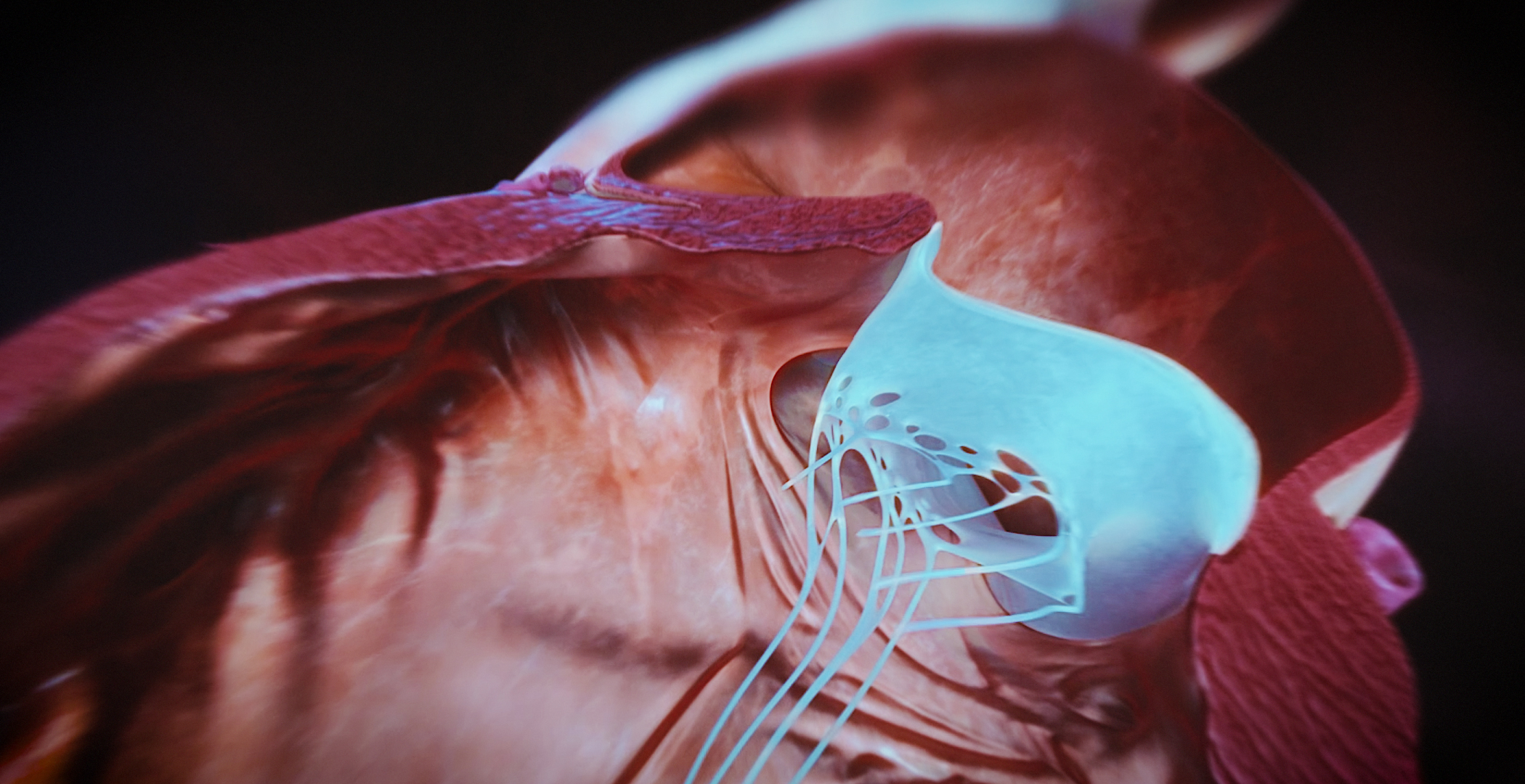 Animacja medyczna 360 stopni, widok serca, przekroje i symulacja z animacji 3D. Medical Animation 360 degree, heart view, cross-sections and simulation from 3D animation.