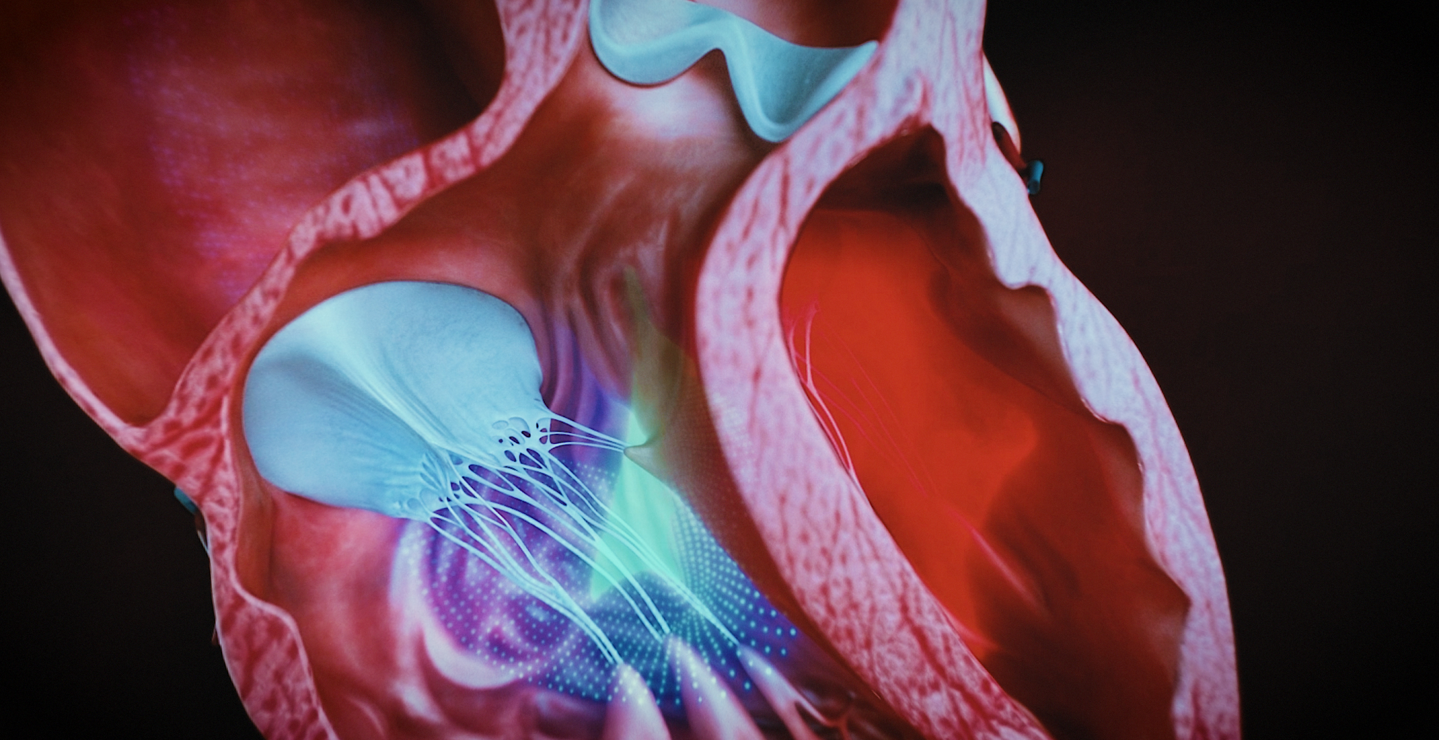 Animacja medyczna 360 stopni, widok serca, przekroje i symulacja z animacji 3D. Medical Animation 360 degree, heart view, cross-sections and simulation from 3D animation.