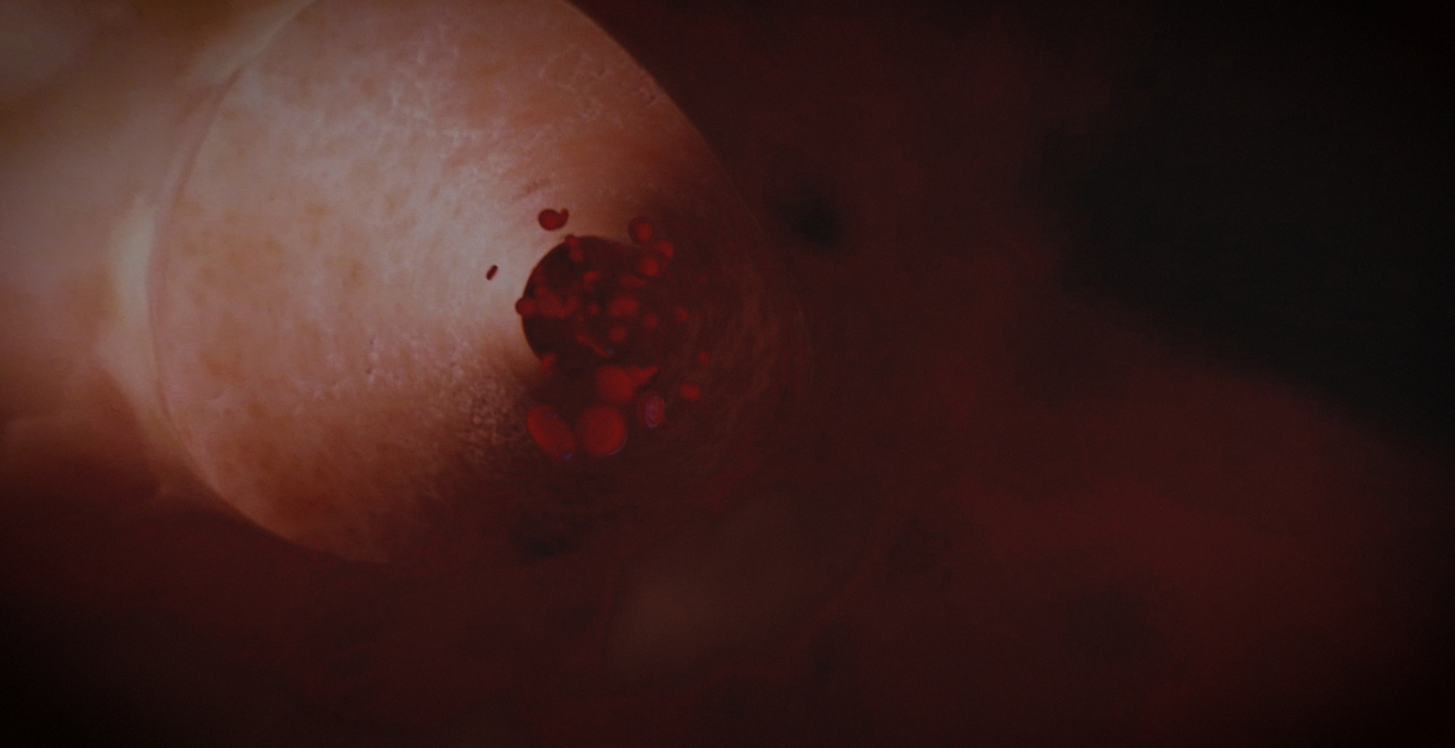 Animacja medyczna 360 stopni, widok serca, przekroje i symulacja z animacji 3D. Medical Animation 360 degree, heart view, cross-sections and simulation from 3D animation.