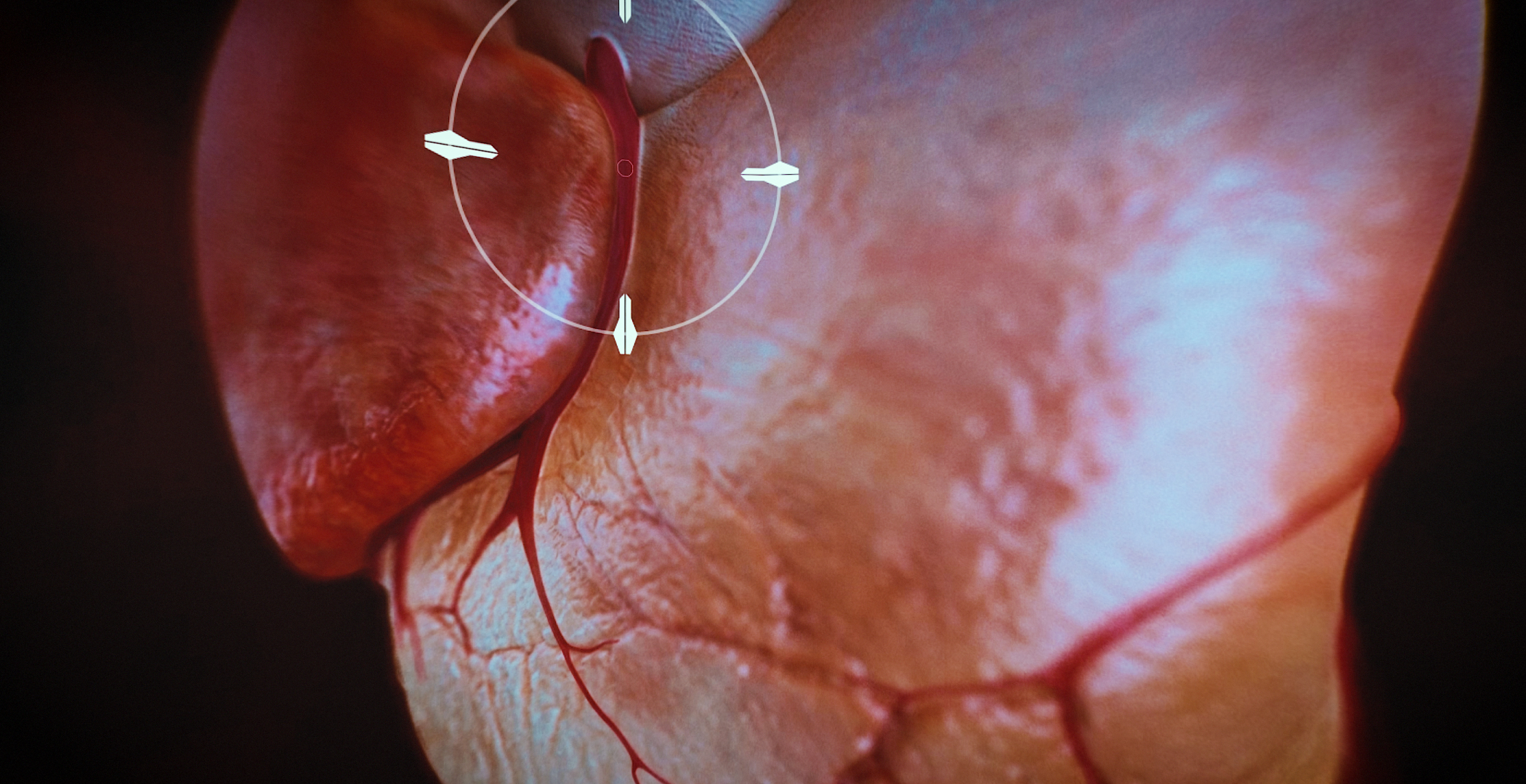 Animacja medyczna 360 stopni, widok serca, przekroje i symulacja z animacji 3D. Medical Animation 360 degree, heart view, cross-sections and simulation from 3D animation.